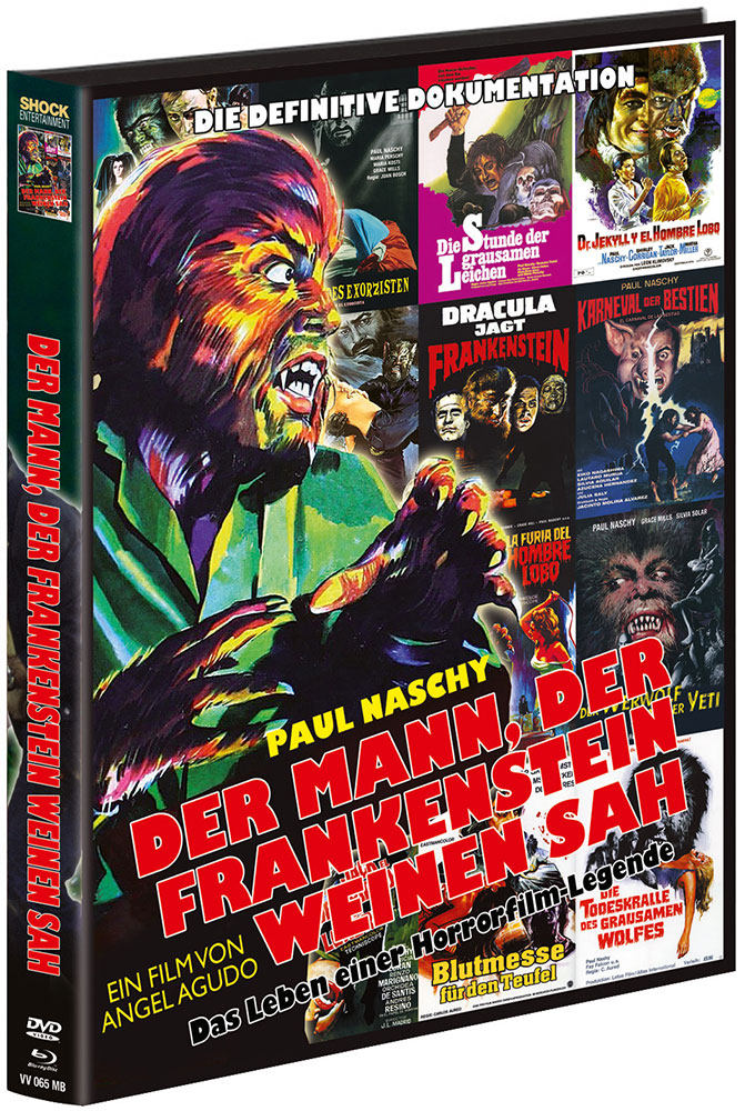 Der Mann, der Frankenstein weinen sah (Blu-Ray+DVD) - Mediabook - Limited 1500 Edition