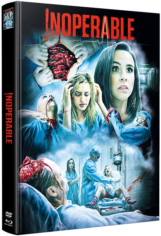 Inoperable (Blu-Ray) (2Discs) - Mediabook (Wattiert) - Limited 150 Edition Inoperable (Blu-Ray) (2Discs) - Mediabook (Wattiert) - Limited 150 Edition