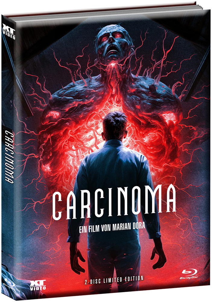 Carcinoma (Blu-Ray+DVD) - Cover 2 - Mediabook (Wattiert) - Limited 500 Edition - Uncut