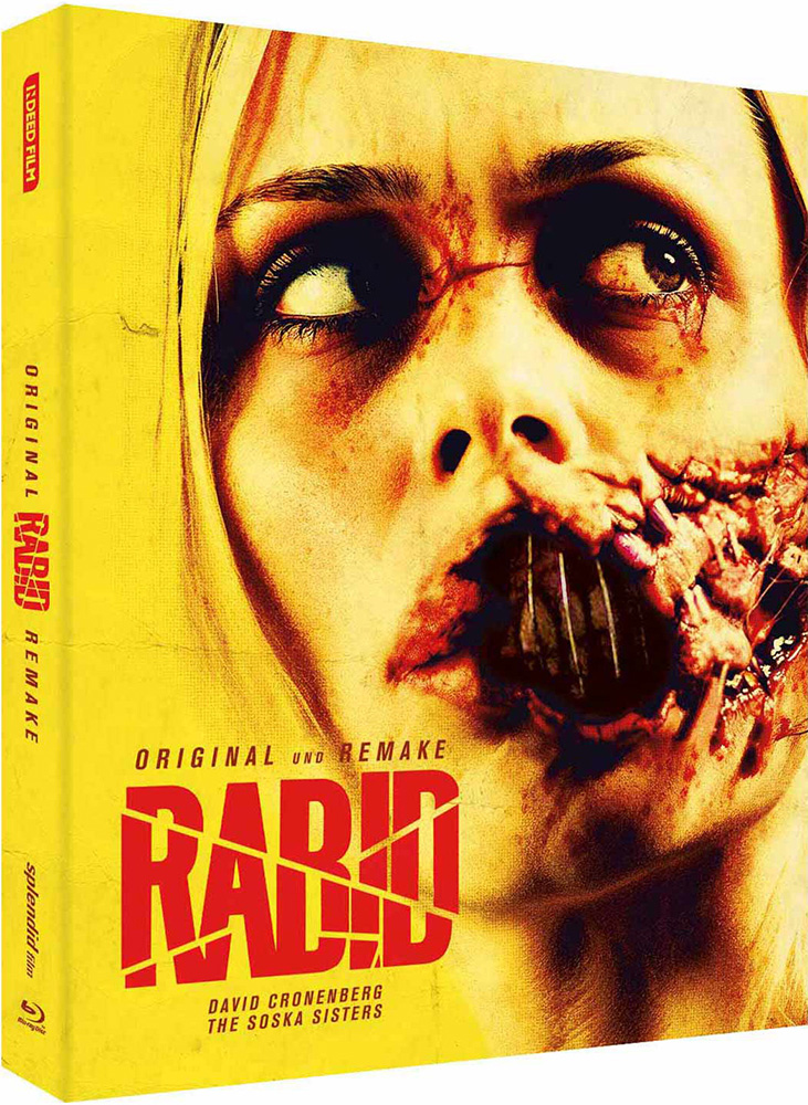 Rabid (Blu-Ray) (2Discs) - Original & Remake - Scanavo Box - Limited Edition - Uncut